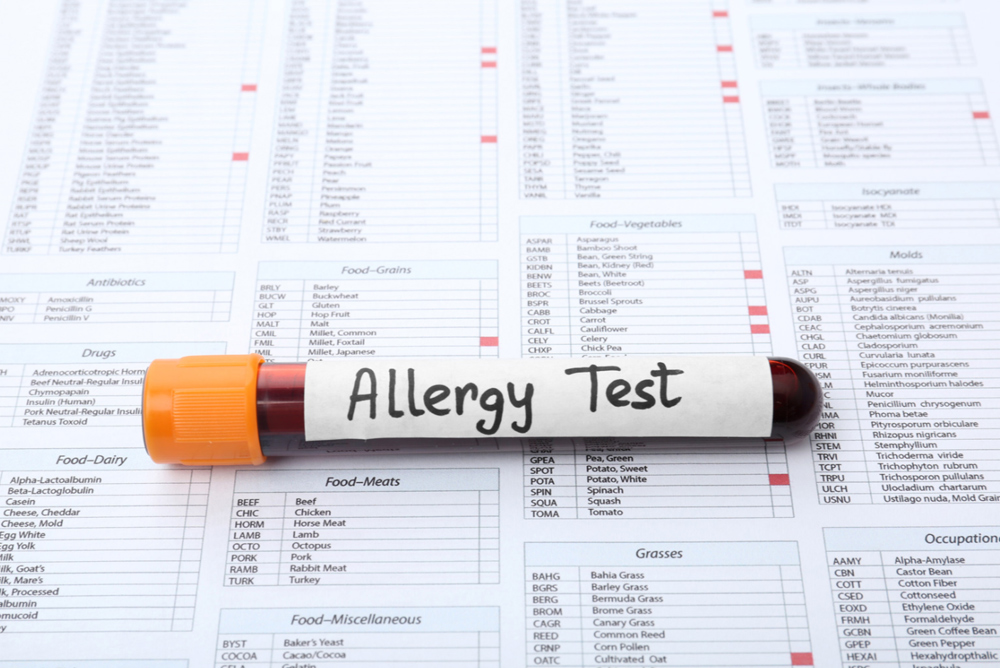 allergy test